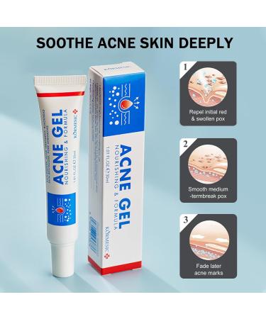 Anti Acne Face Cream Ance Gel Nourishing Formula - Buy Online on GoSupps.com