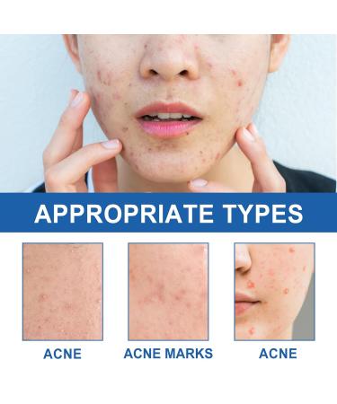 Buy Facial Acne Patches - Hydrocolloid Treatment with Tea Tree Oil & Salicylic Acid | 216 Tablets for Pimples & Blemishes - Buy Online on GoSupps.com