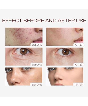 Peeling Solution S rum hydratant pour le visage Exfoliant Exfoliant S rum visage Anti- ge Hydratant pour des pores clairs des lignes fines et une peau clatante - Buy Online on GoSupps.com