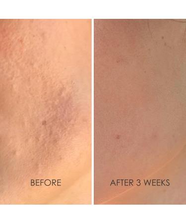 REFLEKT 2 Collagen Boost Vitamin C Serum - Enhance Your Skin's Radiance International Shipping Available - Buy Online on GoSupps.com