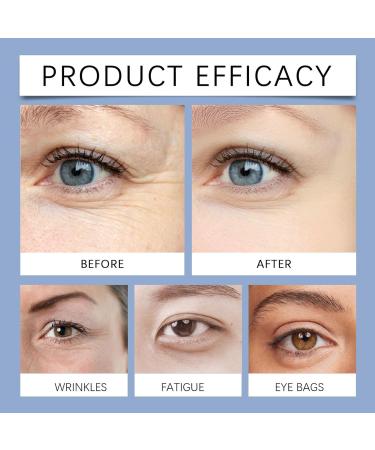 Awaken Peptide Lifting Eye Gel Eye Cream Eye Cream Against Wrinkles and Dark Circles Reduces Fine Lines and Wrinkles Eye Gel Deep Hydration (2) - Buy Online on GoSupps.com