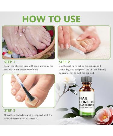  Sikeydels Foot Nail Care Nourish and Soothe Nails Strengthens Nail Structure Nail Treatments with 1 Nail File 30ml - Buy Online on GoSupps.com