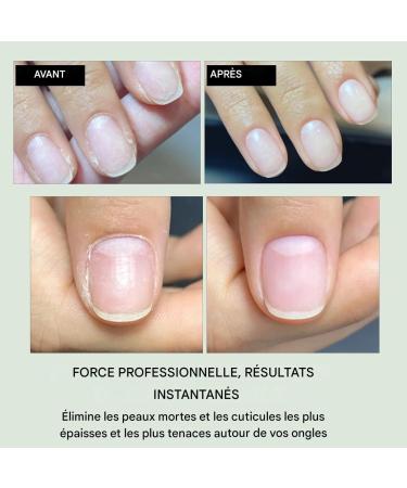 Huile Adoucissante Pour Ongles 12ml Hydratation Profonde et Longue Dur e | Liquide Hydratant Ongles Ab m s | pour Hommes et Femmes Gar ons et Filles Jeunes et Adolescents Fils et Fille Famille - Buy Online on GoSupps.com