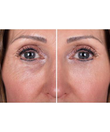 DERMAWORKS Instant Face Lift Serum for Dark Circles, Puffy Eyes & Wrinkles - Buy Online on GoSupps.com