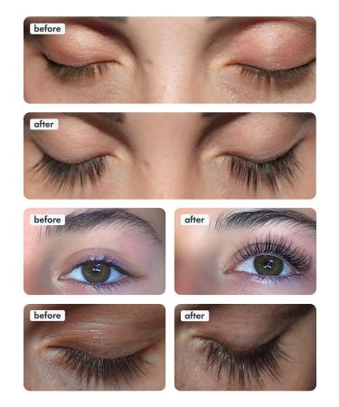 TOPLASH Eyelash Growth Serum - Natural, Cruelty-Free, Hypoallergenic Formula for Longer, Thicker Brows & Lash Boost - 0.1 fl.oz - Buy Online on GoSupps.com