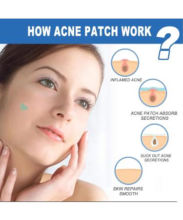 Buy Facial Acne Patches - Hydrocolloid Treatment with Tea Tree Oil & Salicylic Acid | 216 Tablets for Pimples & Blemishes - Buy Online on GoSupps.com
