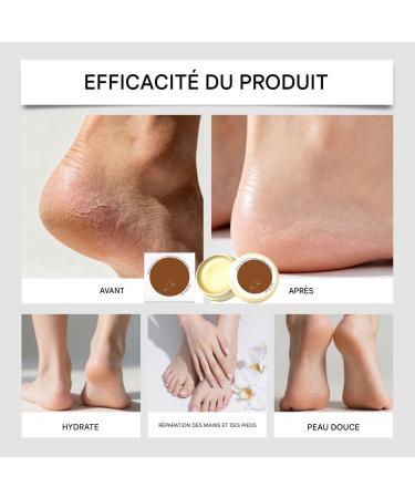 Dry Hand Cream | Anti-Freeze Repairing Lotion for Heels | Cream for Dry Feet for Dead Skin Women Men Seniors Athletes Toes Elbows Autumn - Buy Online on GoSupps.com