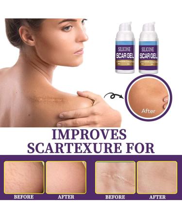 Effective Scar Cream for Old & New Scars | Smooth Skin Care - 30 ml | International Shipping Available - Buy Online on GoSupps.com