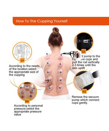 Cupping Jars Set - Traditional Chinese Cupping Tools for Pain Relief & Qi Circulation | International Shipping - Buy Online on GoSupps.com