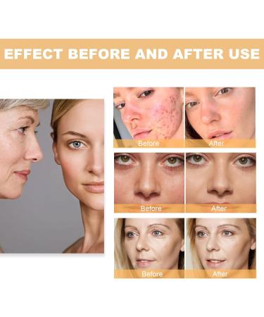 Glycolic Acid 7% Toning Solution for Face - Resurfacing and Peeling Serum - Buy Online on GoSupps.com