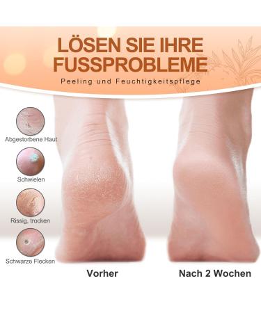 Foot Care Set - 5 Pairs La. Personal Foot Masks Peeling Socks & Heel Repair for Calluses & Dry Skin - Buy Online on GoSupps.com