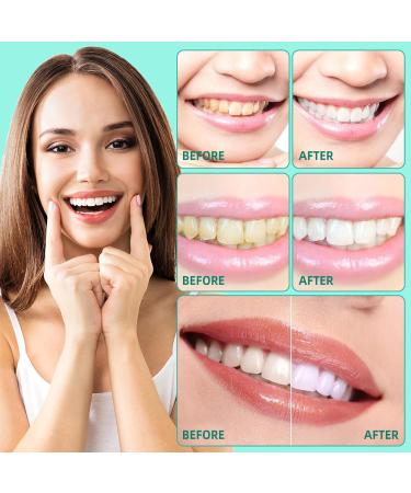 Coconut Pulling Oil - 120ml Mint Mouthwash | Natural Alcohol-Free Teeth Whitening & Gum Health | Includes Tongue Scraper - Buy Online on GoSupps.com