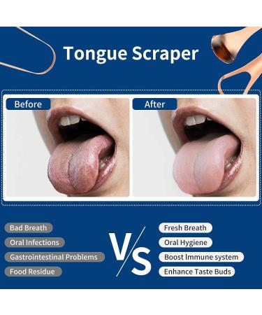 Stainless Steel Tongue Scraper Set - Rose Gold | Reduce Bad Breath, Maintain Oral Hygiene for Adults & Kids - Buy Online on GoSupps.com