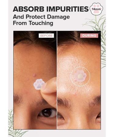I DEW CARE Happy Paws Starlit Kitten Set - Pimple Patches & Eye Patches with Headband | International Shipping Available - Buy Online on GoSupps.com