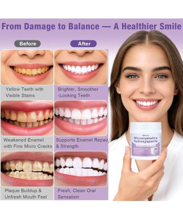 Microcrystalline Hydroxyapatite Powder for Teeth MCHA Tooth Powder Supports Enamel-Friendly & Gentle Whitening Fine Tooth Powder for Enamel Care Easy DIY Oral Care Alternative 30g - Buy Online on GoSupps.com