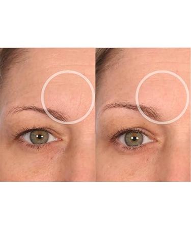 SiO Beauty FaceLift: Overnight Anti-Wrinkle Patches for Neck, Forehead, Eyes & Smile â€“ Smoothing Silicone for Fine Lines & Aging - Buy Online on GoSupps.com
