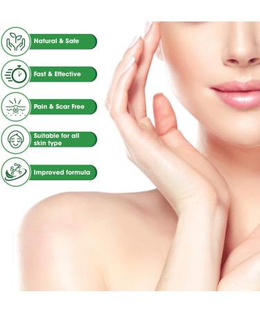 TUHIMO Pimple Patch Removal Device Pimple Remover for All Skin Types Herbal Condensed Patch for Small Large Pimples Wart - 72 Patches Bioclear Skin Tag Remover 1.0 count - Buy Online on GoSupps.com