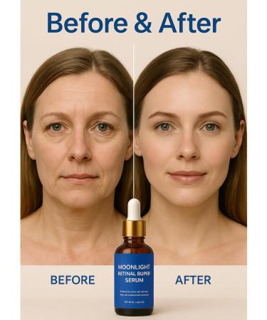  Nuvilo Retinal face serum - Retinaldehyde night serum - Night face serum - Vitamin A serum for women - Smoothing and firming serum for improved skin texture - Buy Online on GoSupps.com