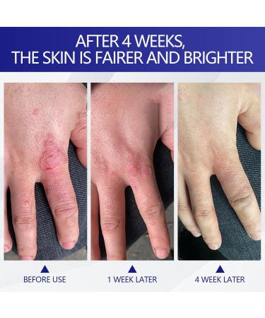 TULAMORIY 100 ml foot care cream moisturizing and anticracking foot cream foot cream for very dry feet deep care for cracked heels heel balm relieves itching for dry and elbows - Buy Online on GoSupps.com