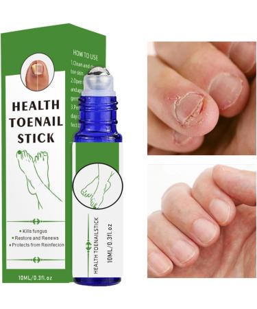  Esncddym Cracked Toenail Repair Roll On Cuticle Oil Health Toenail Stick Roller 0.3 ml Natural Soothing Softening Nail Repair Deep Penetration Nourish For Foot & Hand Care - Buy Online on GoSupps.com