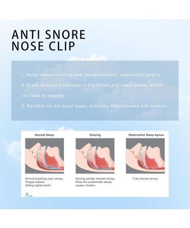 Zriol Nose Clip for Snoring Relief | Anti-Snoring Magnetic Clip (24PCS) | Stop Snoring Fast | International Shipping - Buy Online on GoSupps.com