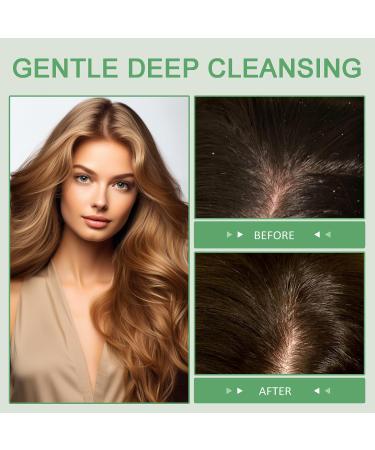 Raw Batana Oil for Hair Growth | 100% Pure Organic Oil for Thickness & Nourishment | Batana Hair Growth Oil with Vitamin E - 4.2 OZ - Buy Online on GoSupps.com