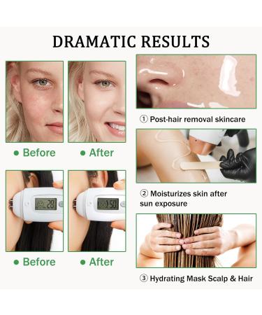 Hydrating Travel Size Aloe Vera Gel for Sunburn Relief | Fast Absorbing Non-Sticky After Sun Lotion for Face - Buy Online on GoSupps.com