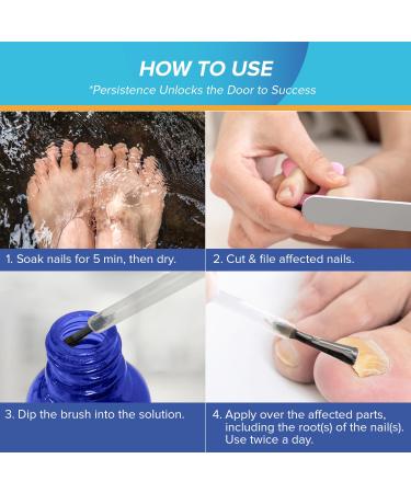 Extra Strength Toenail Fungus Treatment - 1% Tolnaftate for Discolored Nails & Athlete's Foot (30ml) - Fast-Acting OTC Formula - Buy Online on GoSupps.com