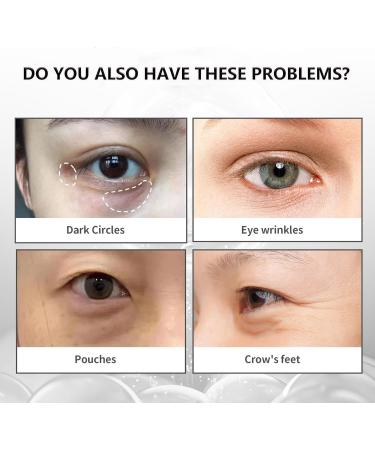 Instant Eye Tightener - Eye Bag Cream - Instant Firm Eye Cream for Dark Circles and Reduce Puffiness - Fade Fine Lines - Tightens and Smoothes Fine Lines for Women/Men - Buy Online on GoSupps.com