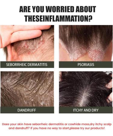  MagiSel Anti-dandruff cream folliculitis cream 20 g intense nutrition gel relieves dry and seborrheic acne and itchy skin soothing and refreshing feeling for a - Buy Online on GoSupps.com