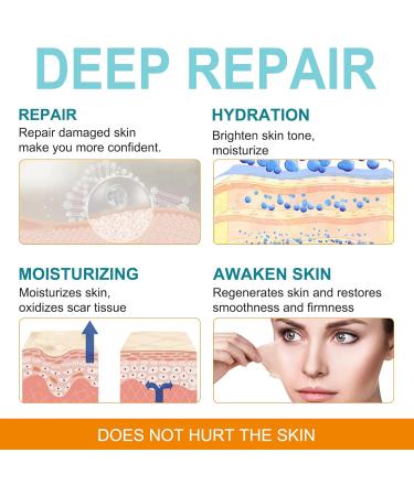 VOGSIG - Silicone Scar Sheets 1.6” x 150” Silicone Scar Tape - Buy Online on GoSupps.com