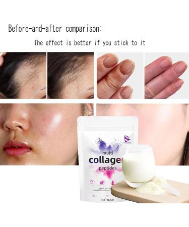 Multi Collagen Protein Powder Multi Collagen Peptides Types i ii iii v x Hydrolyzed Collagen Peptides with Hyaluronic Acid Biotin & Vitamin C Unflavored Collagen Peptides (1) - Buy Online on GoSupps.com