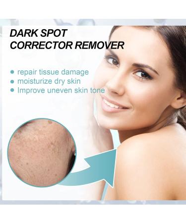 Dark Spot Remover For Face Hyperpigmentation Treatment Dark Spot Serum Melasma treatment for face Blemish spot treatment Freckle Remover for Sun Spots Acne Scars Melasma for Men & Women 30g - Buy Online on GoSupps.com