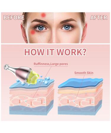 USION Ice Face Roller & Gua Sha - 2-in-1 Facial Massager for Glowing Skin Eyes & Neck | Upgraded Ice Cube Mold & Spray Bottle - Pink - Buy Online on GoSupps.com