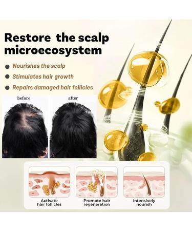 S rum d'huile nourrissant les cheveux formule de renforcement pour l'apparence plus compl te traitement de l'activateur de volume naturel pour les pointes s par es frisottis plus fluide pour l'util - Buy Online on GoSupps.com
