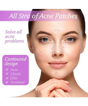 Acne Pimple Patches for Large Zit Breakouts - 102 Hydrocolloid Bandages with Tea Tree & Salicylic Acid - Buy Online on GoSupps.com