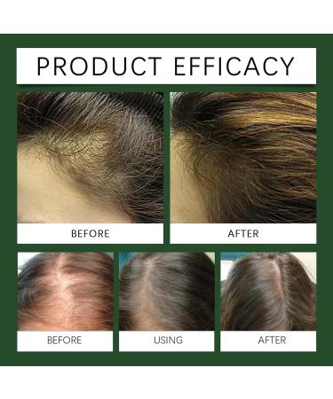 Batana Oil for Hair Growth Natural Batana Oil for Healthier Thicker Fuller Hair Promote Hair Regrowth Organic Batana Oil for Men & Women Leaves Your Hair Smoother Oil - Buy Online on GoSupps.com