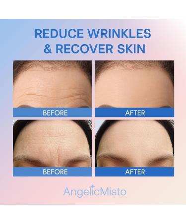Silicone Forehead Wrinkle Patches - Reusable Anti-Wrinkle Overnight Treatment - 3 PCS for Smooth Skin - Buy Online on GoSupps.com