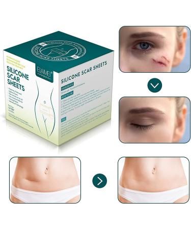 Soft Silicone Scar Sheets - Medical Grade, Waterproof & Reusable - 4CM x 300CM - Buy Online on GoSupps.com