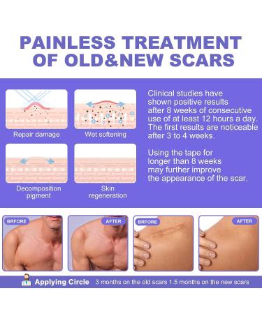 OK TAPE Silicone Scar Tape Roll - Professional Scar Removal Sheets for Surgical Scars - Reusable Silicone Strips for Keloid, C-Section, Tummy Tuck - 1.6 x70 Roll - Buy Online on GoSupps.com