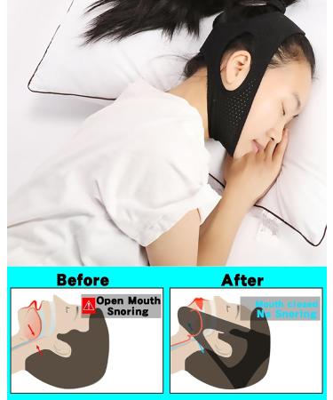 Buy Anti Snoring Chin Strap - Post Surgical Compression Garment for Men & Women - Improve Sleep & Comfort (Black - Buy Online on GoSupps.com