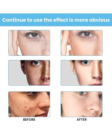 Set of 3 Creams for Manchas Oscuras en La Cara Cremas for Quitar Manchas de La Cara Crema para Manchas en La Cara Crema para Las Manchas de La Cara 20 g - Buy Online on GoSupps.com