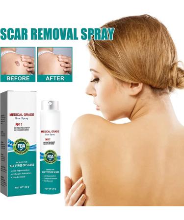 Medical Grade Scar Spray Effective Scar Removal for Surgical Scars & Stretch Marks | All Skin Types - Buy Online on GoSupps.com