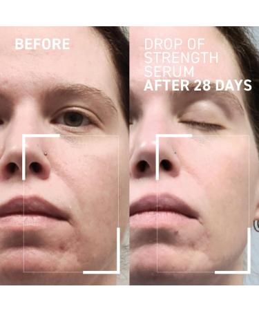 Dr. Brandt Drop of Strength All-Day Strengthening Serum Bundle - Enhances Skin Resilience & Provides Instant Hydration - 0.5 fl oz + 1.0 fl oz - Buy Online on GoSupps.com