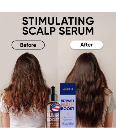 MOERIE S rum de Pousse de Cheveux Croissance Naturelle & paississement Capillaire Traitement anti-chute et anti-affinement pour femme S rum de repousse de cheveux rapide Alternative naturelle 50ml x2 - Buy Online on GoSupps.com