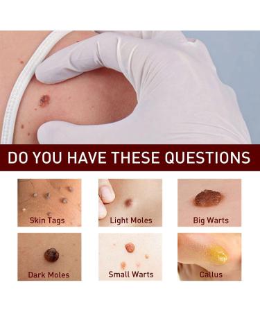 ZRREMRE Skin Flaps and Birthmark Remover Wipe Away Skin Flaps and Birthmarks 3 Pack Extreme Removal Instant Painless Removal for Skin Warts and Birthmarks - Buy Online on GoSupps.com
