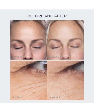 Anti-Aging Peptide Under Eye Cream | Hydrated & Firm Skin | Reduces Dark Circles & Puffiness | Crows Feet & Fine Lines Treatment (0.5 oz - Buy Online on GoSupps.com