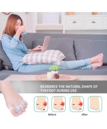 Silicone Toe Separators (2 Pair) - Toe Straighteners and Spacers for Curled, Overlapping Toes - Toe Stretcher for Toe Relaxation and Relief - Transparent Color - Buy Online on GoSupps.com