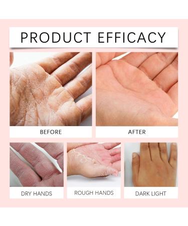 WRANBAO Retinol Antiaging hand cream firming antiaging hand lotion with collagen antiwrinkle cream for hands deeply hydrates and greasy nongreasy suitable for dry skin 5 pieces 5 pieces - Buy Online on GoSupps.com