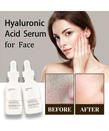 Hyaluronic Acid 2% + B5 30ML Serum for Dark Spot Removal and Hydration - Plump and Smooth Skin for All Skin Types - Skin Care 1PCS - Buy Online on GoSupps.com